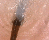 显微镜下拔胡子，好长的一根胡子 - Under a microscope, a beard, a long beard