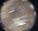 耳洞里有个活蛾子， 耳洞太大的副作用，这么大的都进得去 - There is a live moth in the ear hole, too big side effect of the ear hole, so big can get in.