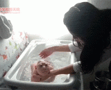 小头畸形，稀有的遗传病，大脑发育不良，基本上都有严重的智商缺陷 - Small head defects, rare genetic diseases, and hypoplasia of the brain are basically serious IQ defects.