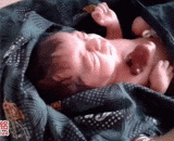 心脏长在外面的孩子 - A child with a heart outside