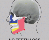What happens when a person loses all his teeth?,当一个人失去了全部牙齿，会发生什么！