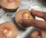 痘痘杯子蛋糕，简直下了不嘴啊 - Acne cup cake, it is almost no mouth