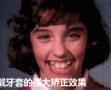 戴牙套的强大矫正效果，惊呆了 - The powerful correction of wearing a dental cover was stunned.