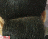 虱子头，看的头皮发麻 - The head of the lice, the scalp and the numbness